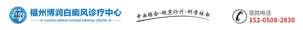 福州专门治疗白癜风的医院-福州看白癜风哪个医院好-福州较好白癜风专科医院-福州治白癜风要